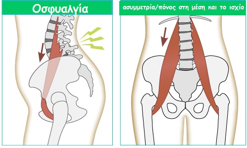 psoas dysfunction gr