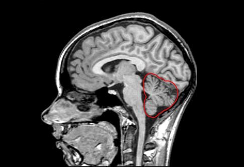 cerebelum