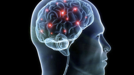 neurotag