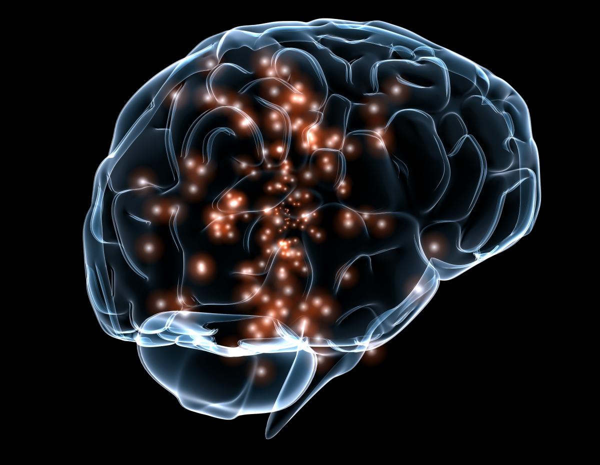 neurotag1